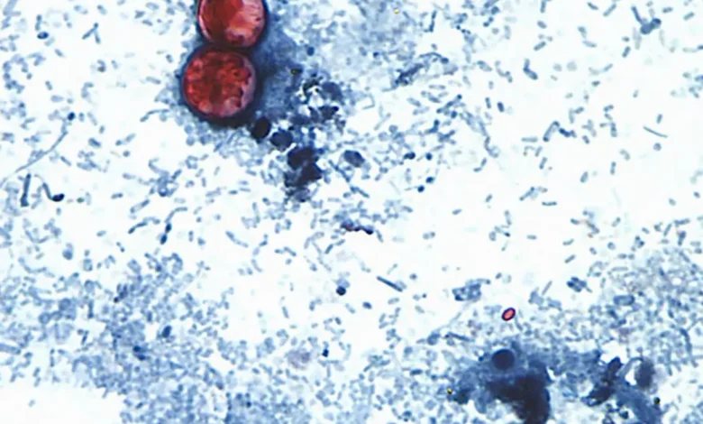 estados unidos confirma dos muertes por brote de ciclosporiasis asociado al parásito cyclospora
